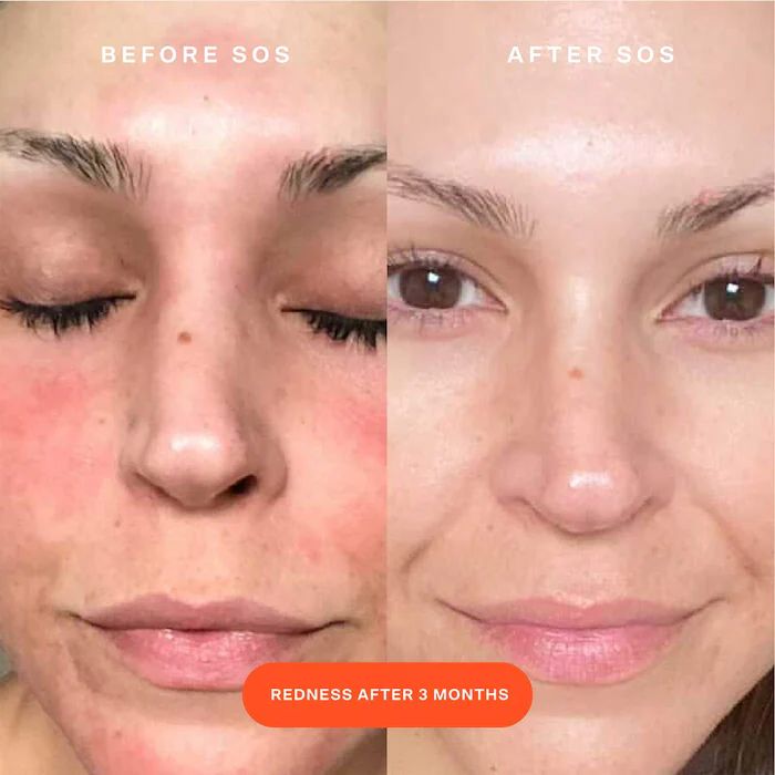 Tower 28 Beauty SOS Daily Rescue Facial Spray with Hypochlorous Acid