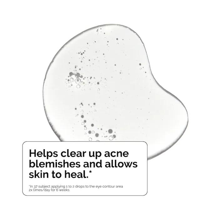 The Ordinary Salicylic Acid 2% Solution